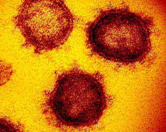 Imagen del coronavirus SARS-Cov-2