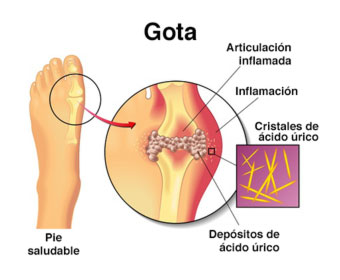 Imagen relacionada