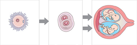 diagrama de un solo huevo fertilizado spliting en dos