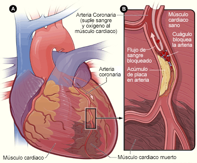 corazon